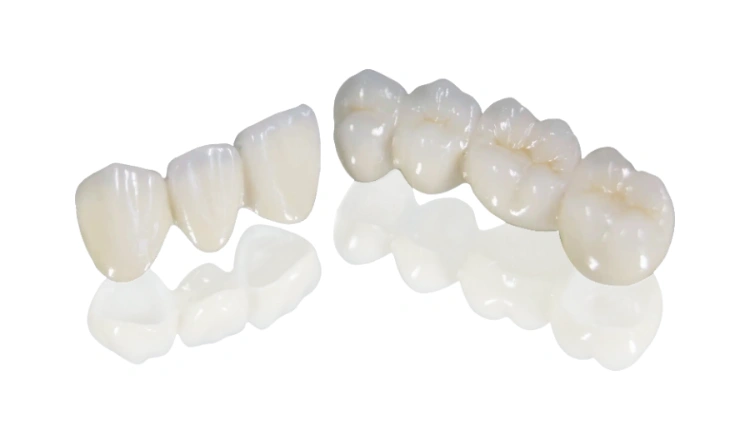 Alumina all-ceramic teeth